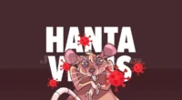 Kematian Akibat Hantavirus